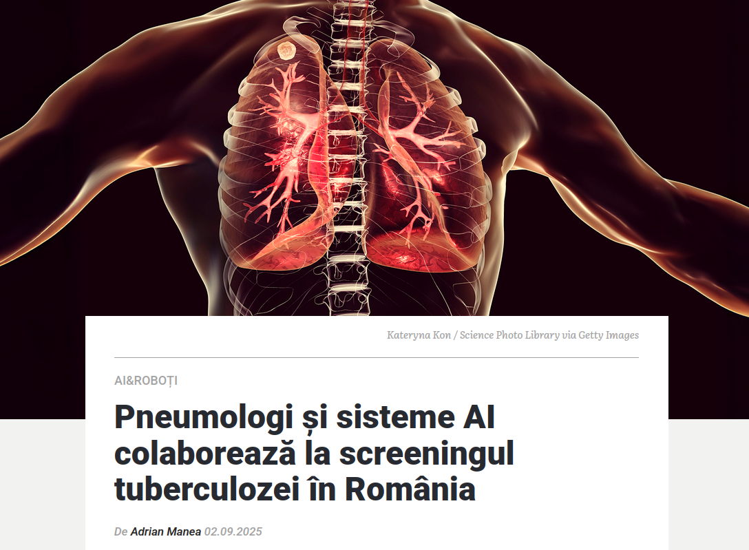 Articol pneumologi la Mindcraft